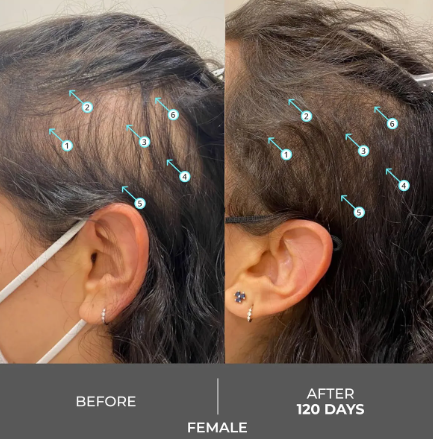 DS LABS SHAMPOO REVITA 120ML