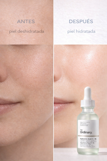 Ácido Hialurónico Puro que Hidrata en Profundidad