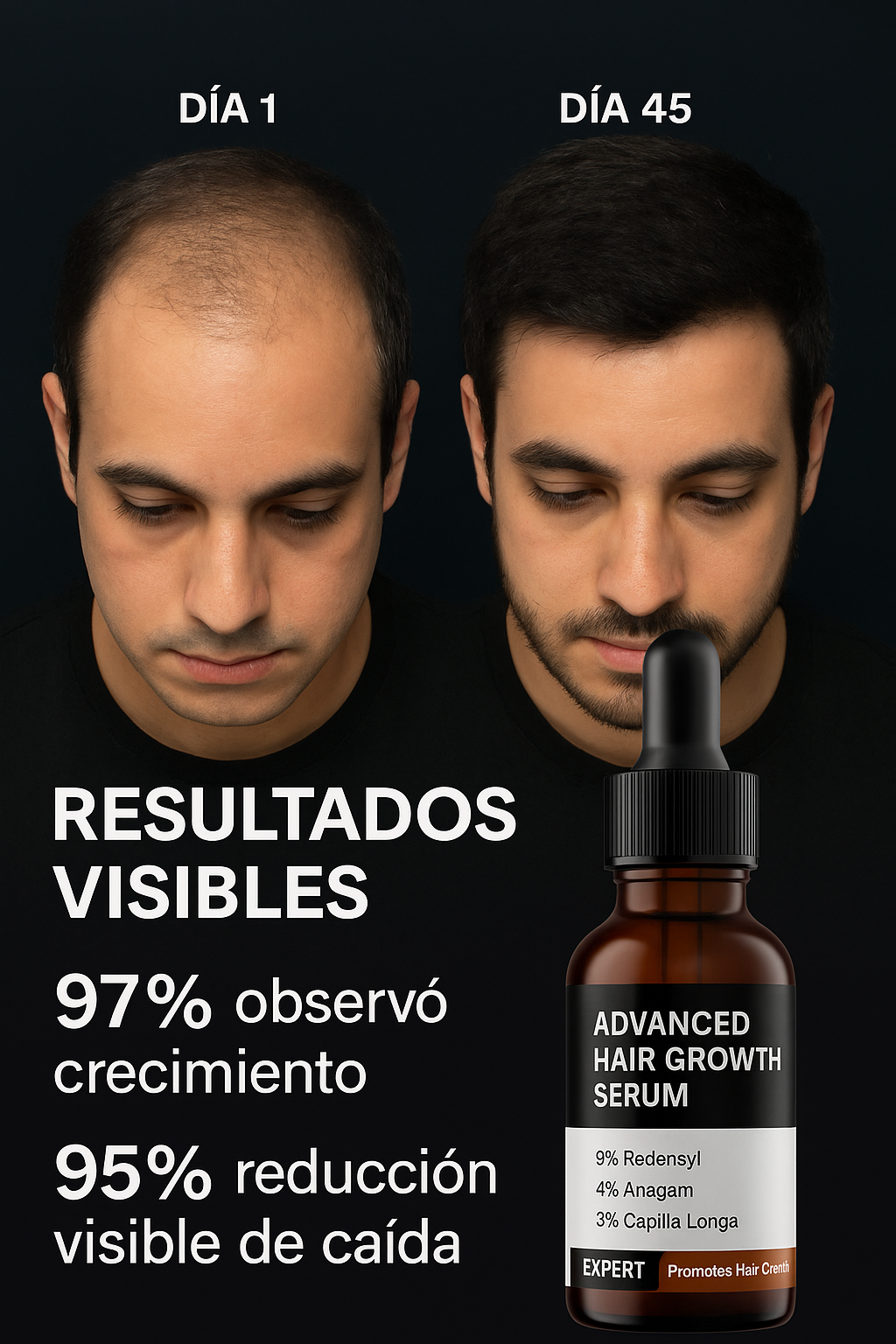 Bare Anatomy Hair Growth 30ml