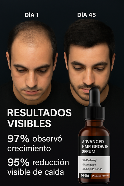 Bare Anatomy Hair Growth 30ml